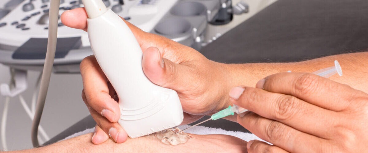 تزریق مفصلی تحت گاید سونوگرافی