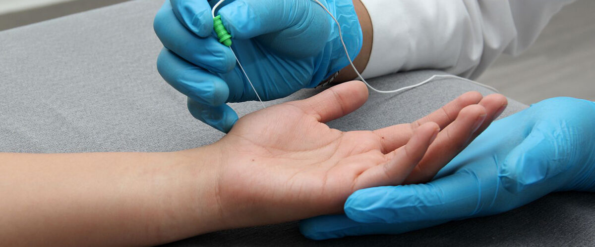 عکس نوار عصب و عضله