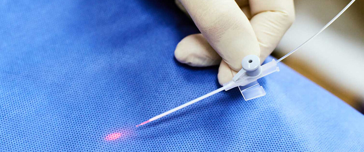 درمان واریس با لیزر