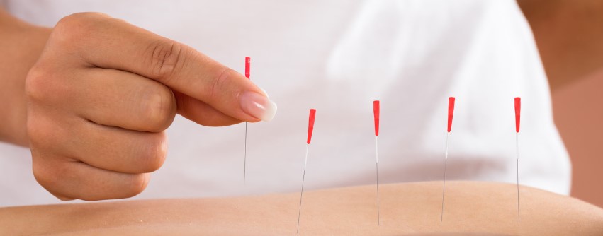 طب سوزنی و طب فیزیکی