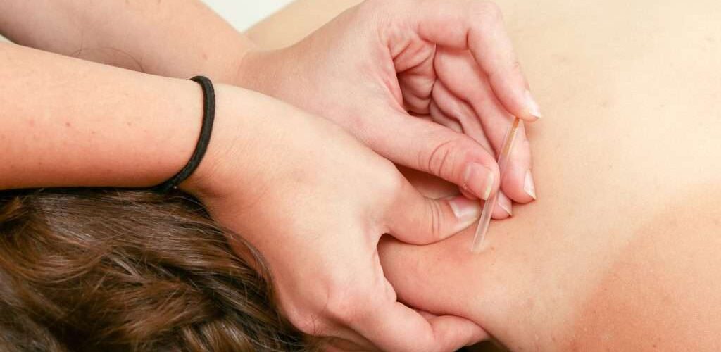 مراقبت های بعد از سوزن درمانی