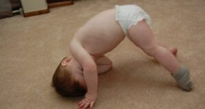 عکس هیپوتونی در بچه ها