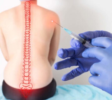 اوزون تراپی دیسک کمر در تبریز