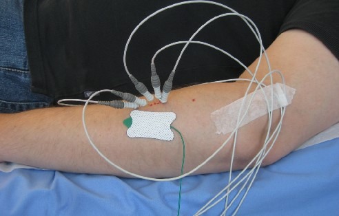 عکس اجرای نوار عصب و عضله