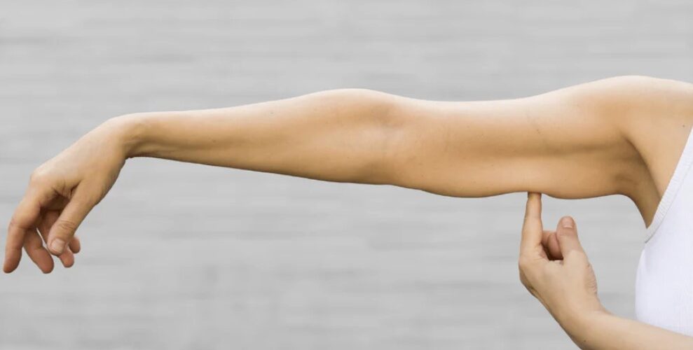 عکس سارکوپنیا