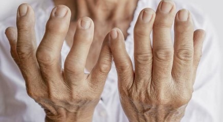 عکس فیزیوتراپی برای بیماران روماتیسمی