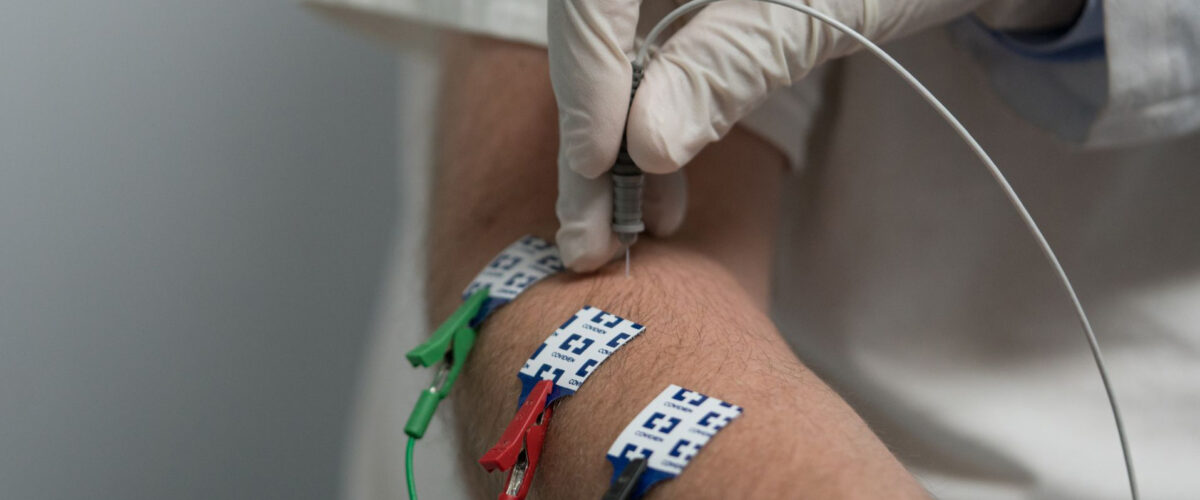 عکس نوار عصب و عضله در تبریز