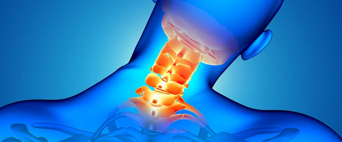 اسپوندیلوز