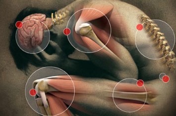 عکس سندروم درد مزمن