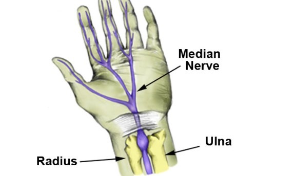 عکس عصب مدین