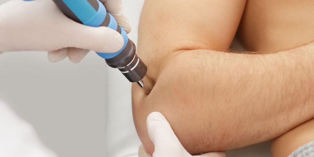 شاک ویو تراپی