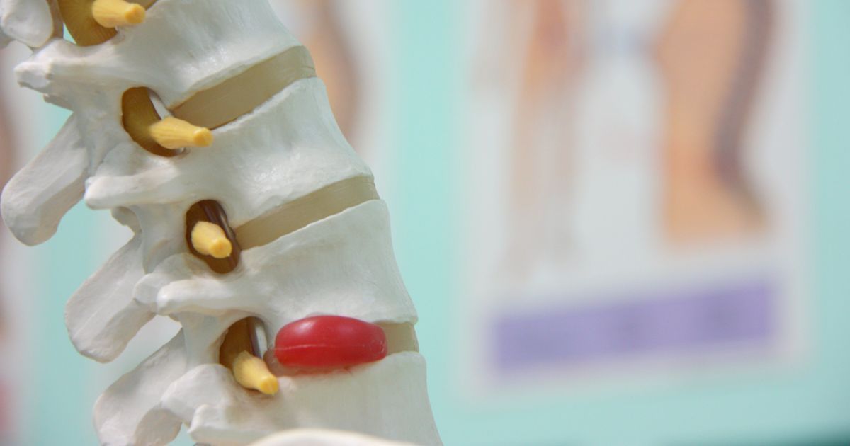 تزریق دیسکوژل