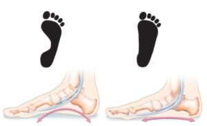 عکس کف پای صاف