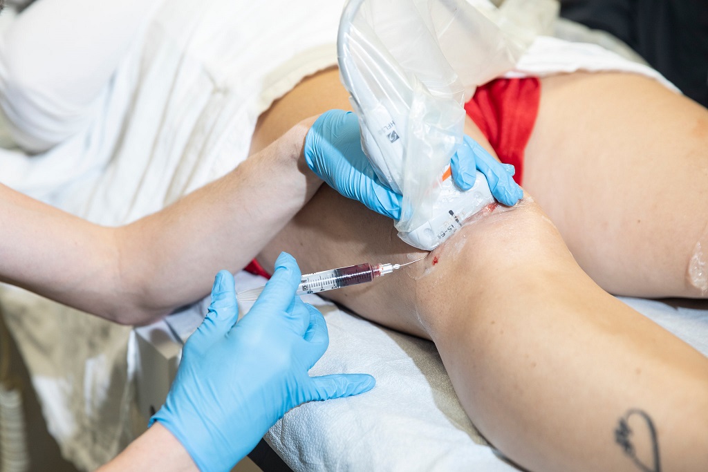 کاربرد سلول درمانی در ترمیم شکستگی های مزمن