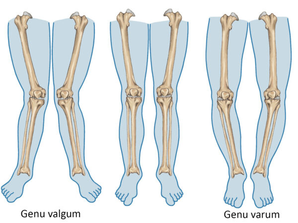 عکس پای پرانتزی
