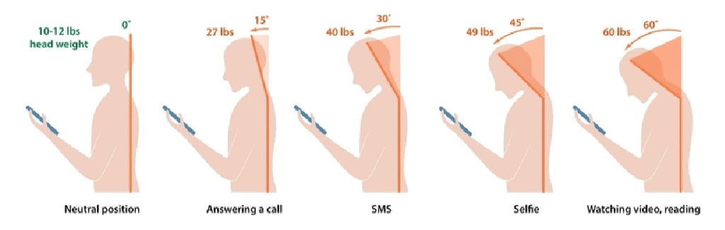 عکس گردن پیامکی زاویه و فشار بر گردن