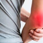 سندرم تونل کوبیتال