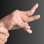 فلج مغزی اسپاستیک